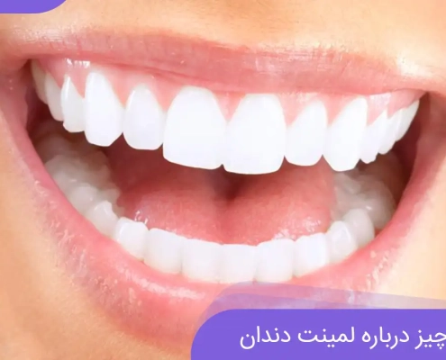 لمینت دندان ارزان