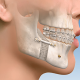 90 درصد تخفیف در هزینه جراحی دندان و فک