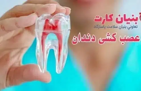 هزینه عصب کشی دندان ۱۴۰۳