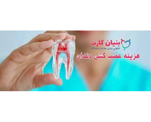 هزینه عصب کشی دندان