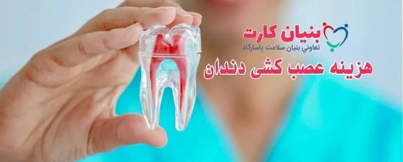 هزینه عصب کشی دندان 1402