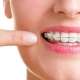 ارتودنسی دندان ارزان