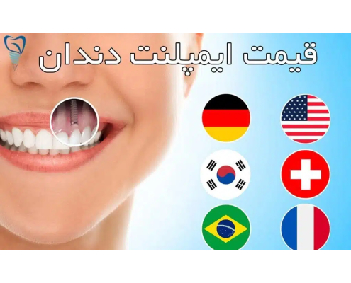 ایمپلنت دندان ارزان