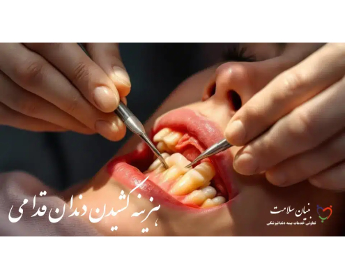هزینه کشیدن دندان قدامی