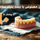 دندان-مصنوعی-با-بنیان-سلامت